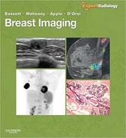 Cover of Breast imaging by Lawrence W. Bassett