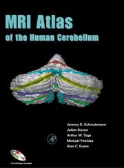Cover of MRI atlas of the human cerebellum by Jeremy D. Schmahmann