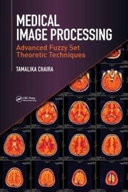 Cover of Medical Image Processing by Tamalika Chaira