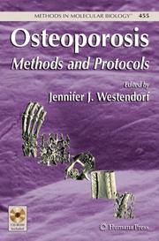Front cover of Osteoporosis by Jennifer J. Westendorf