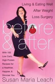 Cover of Before and After by Susan Maria Leach