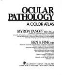 Cover of Ocular pathology by Myron Yanoff