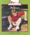 Cover of Bruises by Sharon Gordon