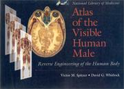 Front cover of Atlas of the visible human male by Victor M. Spitzer