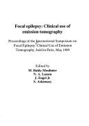 Front cover of Focal epilepsy by International Symposium on Focal Epilepsy (1989 Paris, France)