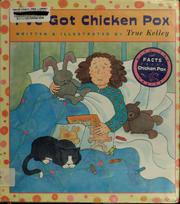 Cover of I've got chicken pox by True Kelley