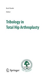 Front cover of Tribology in total hip arthroplasty by European Federation of National Associations of Orthopaedics and Traumatology. Congress